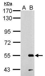 RAD26L Polyclonal Antibody