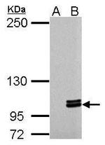 MYO1C Antibody in Western Blot (WB)