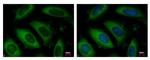 ARD1A Polyclonal Antibody