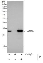 ARD1A Antibody in Immunoprecipitation (IP)