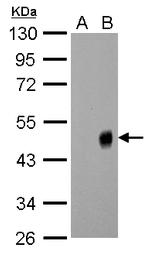 Influenza A H1N1 NA Antibody in Western Blot (WB)