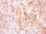 GRB10 Polyclonal Antibody