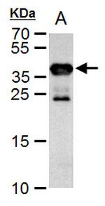 Cre recombinase Antibody in Western Blot (WB)