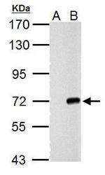 Cre recombinase Antibody in Western Blot (WB)