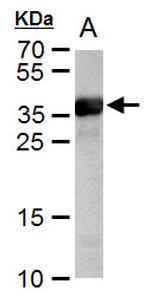 Cre recombinase Antibody in Western Blot (WB)