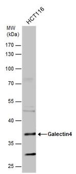 Galectin 4 Antibody in Western Blot (WB)