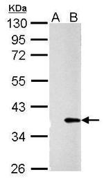 Galectin 4 Antibody in Western Blot (WB)