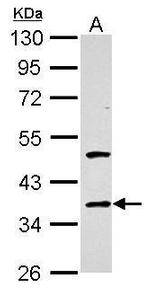 Galectin 4 Antibody in Western Blot (WB)