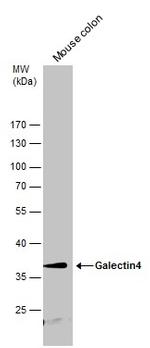 Galectin 4 Antibody in Western Blot (WB)