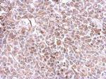Galectin 9 Antibody in Immunohistochemistry (Paraffin) (IHC (P))