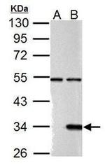 Galectin 9 Antibody in Western Blot (WB)