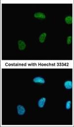 PRMT1 Polyclonal Antibody
