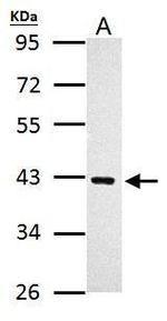 PRMT1 Antibody in Western Blot (WB)