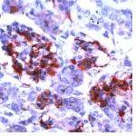 CD99 Antibody in Immunohistochemistry (Paraffin) (IHC (P))