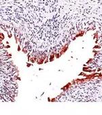 UPK3A Polyclonal Antibody