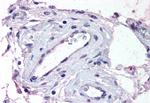 ADAMTS1 Polyclonal Antibody