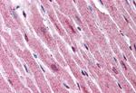 ADAMTS4 Polyclonal Antibody