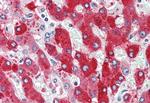 CDCP1 Antibody in Immunohistochemistry (Paraffin) (IHC (P))