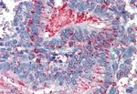 CDCP1 Antibody in Immunohistochemistry (Paraffin) (IHC (P))