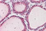 FAM62A Antibody in Immunohistochemistry (Paraffin) (IHC (P))