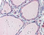 FAM62A Antibody in Immunohistochemistry (Paraffin) (IHC (P))