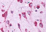 GPR146 Antibody in Immunohistochemistry (Paraffin) (IHC (P))