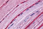 GRK5 Polyclonal Antibody