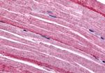 GRK5 Polyclonal Antibody