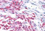 mGluR2 Antibody in Immunohistochemistry (Paraffin) (IHC (P))