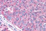 mGluR2 Antibody in Immunohistochemistry (Paraffin) (IHC (P))
