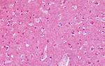 mGluR2 Antibody in Immunohistochemistry (Paraffin) (IHC (P))