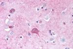 mGluR2 Antibody in Immunohistochemistry (Paraffin) (IHC (P))