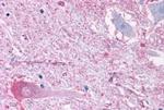 mGluR2 Antibody in Immunohistochemistry (Paraffin) (IHC (P))