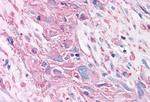 mGluR2 Antibody in Immunohistochemistry (Paraffin) (IHC (P))