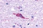 HTR1F Antibody in Immunohistochemistry (Paraffin) (IHC (P))