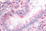 ITGA2 Antibody in Immunohistochemistry (Paraffin) (IHC (P))