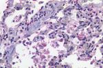 CD11c Antibody in Immunohistochemistry (Paraffin) (IHC (P))