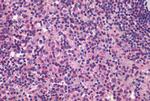 CD11c Antibody in Immunohistochemistry (Paraffin) (IHC (P))