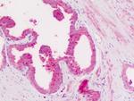 CD11c Antibody in Immunohistochemistry (Paraffin) (IHC (P))