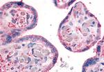 ITGB1 Antibody in Immunohistochemistry (Paraffin) (IHC (P))