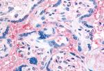 CD61 Antibody in Immunohistochemistry (Paraffin) (IHC (P))