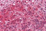 LYPD3 Antibody in Immunohistochemistry (Paraffin) (IHC (P))
