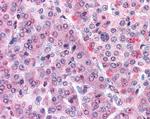 MLEC Polyclonal Antibody