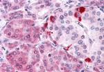 MLEC Polyclonal Antibody
