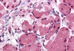 MLEC Antibody in Immunohistochemistry (Paraffin) (IHC (P))