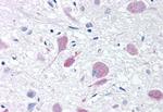 PLA2G3 Antibody in Immunohistochemistry (Paraffin) (IHC (P))