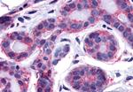 FAK Antibody in Immunohistochemistry (Paraffin) (IHC (P))