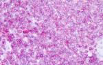 CD45 Antibody in Immunohistochemistry (Paraffin) (IHC (P))