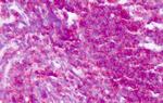 CD45 Antibody in Immunohistochemistry (Paraffin) (IHC (P))