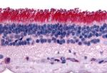 PTPRM Polyclonal Antibody